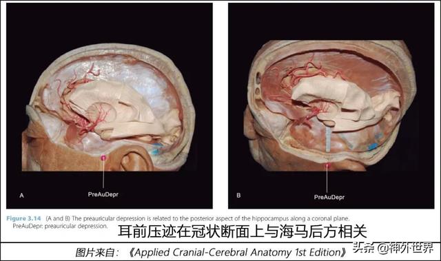 顳骨基礎解剖知識復習